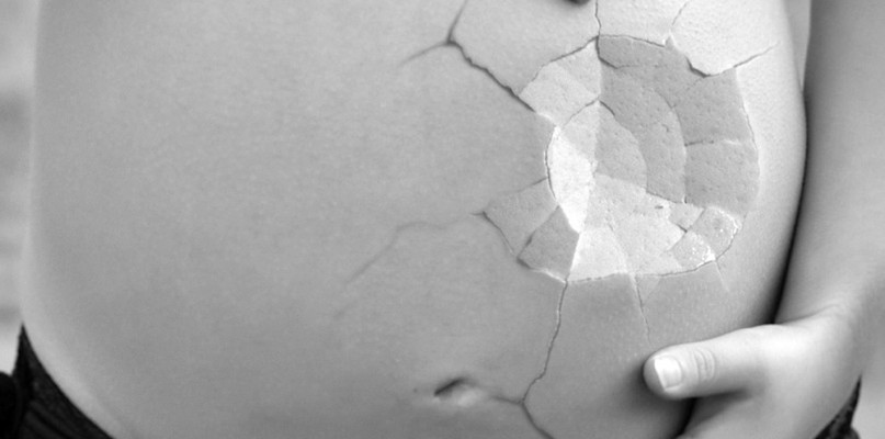 Urazowe pęknięcie macicy a odszkodowanie medyczne. Czy każda poszkodowana pacjentk