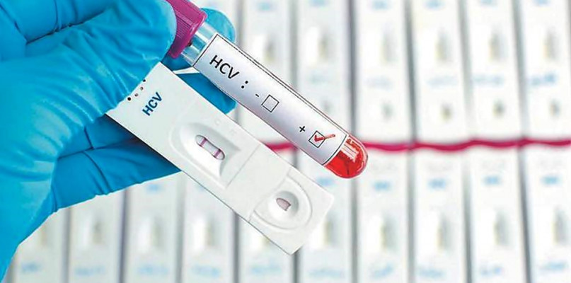 Bezpłatny test na wirusa HCV będzie można wykonać niebawem w płońskim ratuszu
