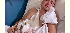 Poważny wypadek Jacka - trzeba uratować jego dłoń