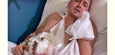 Poważny wypadek Jacka - trzeba uratować jego dłoń-25476