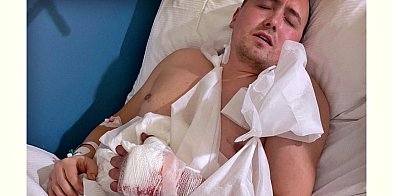 Poważny wypadek Jacka - trzeba uratować jego dłoń-25476