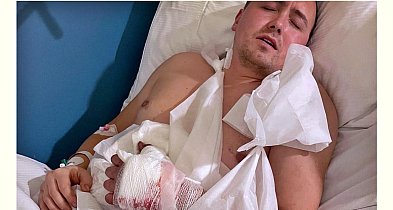 Poważny wypadek Jacka - trzeba uratować jego dłoń-25476