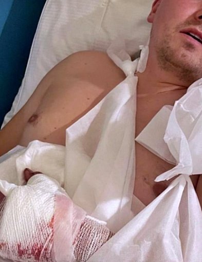 Poważny wypadek Jacka - trzeba uratować jego dłoń-25476