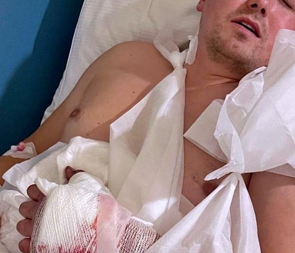 Poważny wypadek Jacka - trzeba uratować jego dłoń-25476